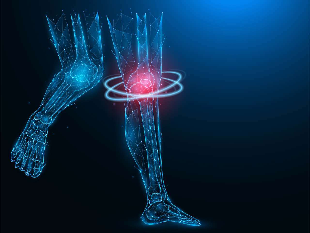 Artroplastia de joelho