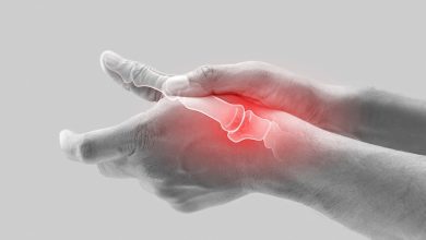 Artrose mais comum na mão: rizartrose