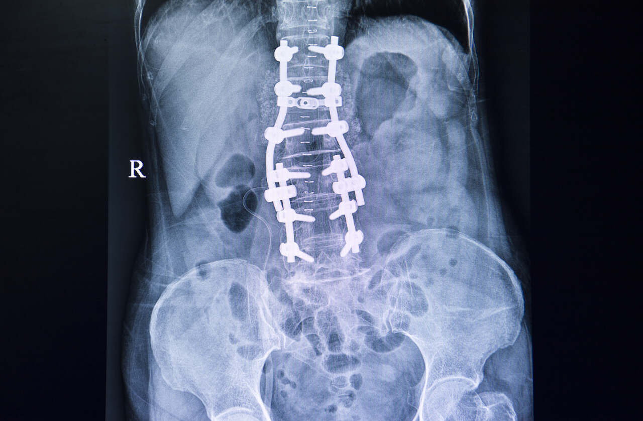 Radiografia ortopédica Traumatologia dor nas costas lesão da coluna  vertebral fotos, imagens de © edwardolive #74476579